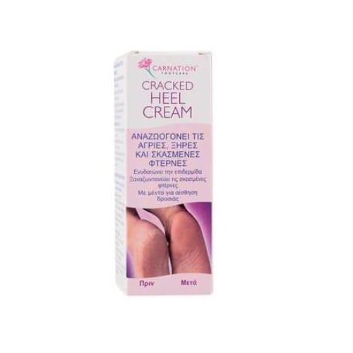 Carnation cracked sale heel cream